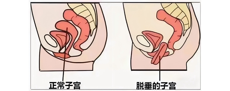 銅川礦務(wù)局中心醫(yī)院婦科成功開展首例腹腔鏡下子宮骶前筋膜懸吊手術(shù) ...